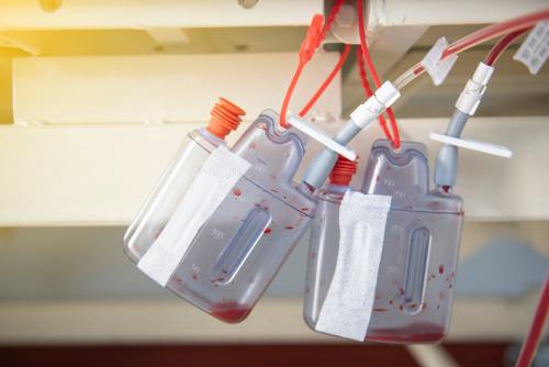 Какие методы дренажа для лица существуют