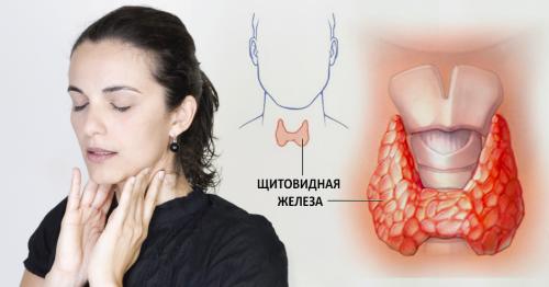 Как лечить щитовидку у женщин дома. Заболевания щитовидной железы: симптомы и лечение
