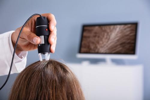 Сильно выпадают волосы, что делать форум. Первые признаки алопеции у мужчин и женщин