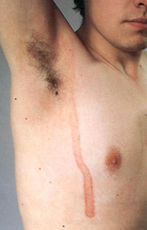 Как убрать возрастные пигментные пятна. Старческие пятна на лице: лечение 07