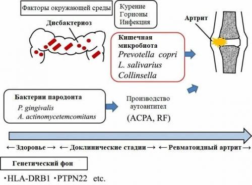 Какова связь между ревматоидным артритом и бактериальными инфекциями